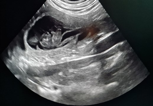 Ultra 19 april